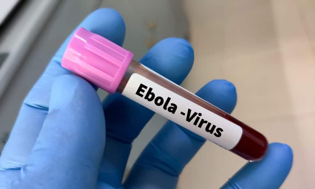 Ministro da Saúde do Congo nega falta de controle sobre surto de Ebola - Imagem do artigo original